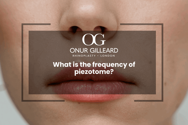 What is the frequency of piezotome?