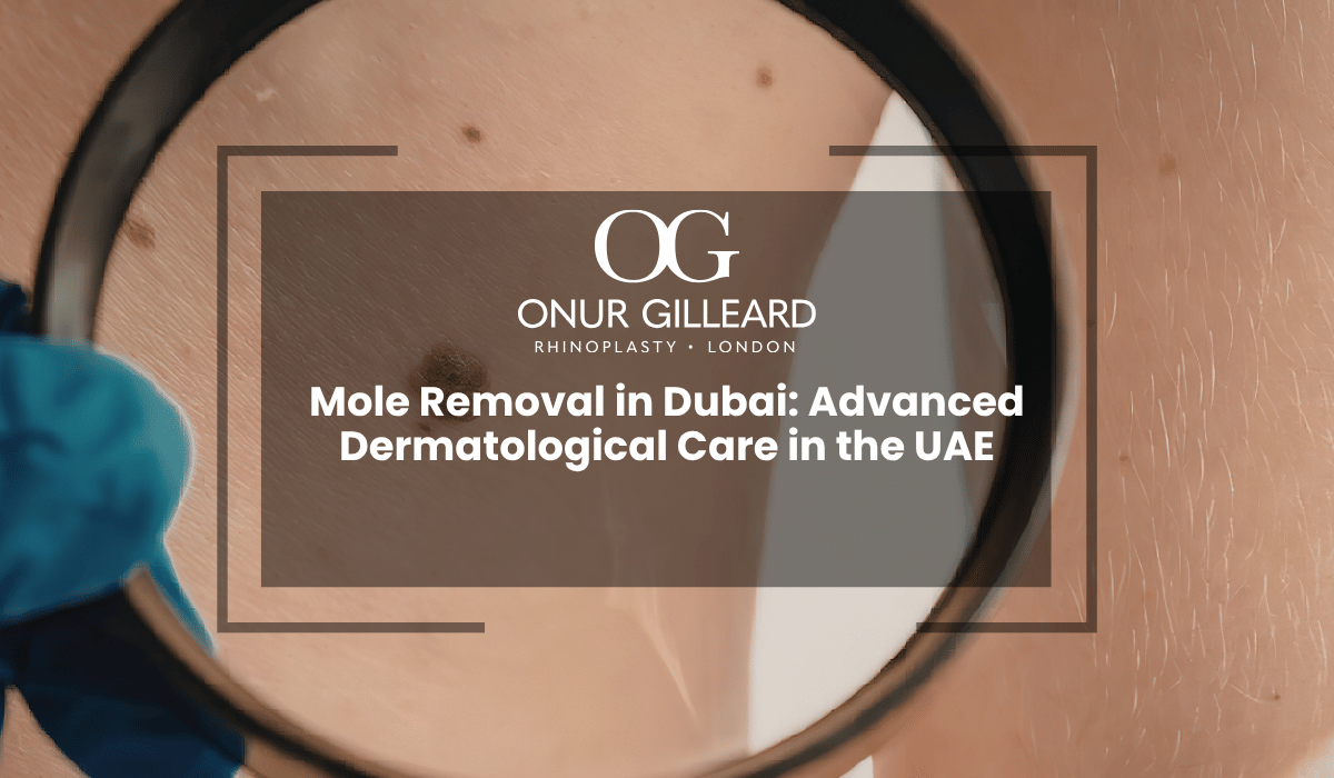 Mole Removal in Dubai: Advanced Dermatological Care in the UAE