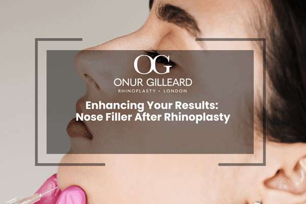 Enhancing Your Results: Nose Filler After Rhinoplasty