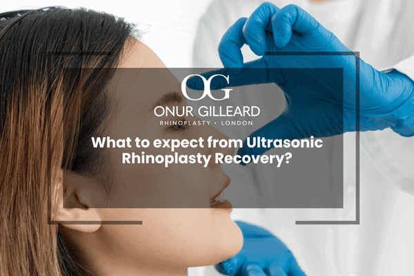 What to expect from Ultrasonic Rhinoplasty Recovery