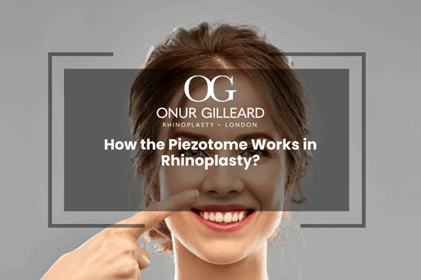 How the Piezotome Works in Rhinoplasty?