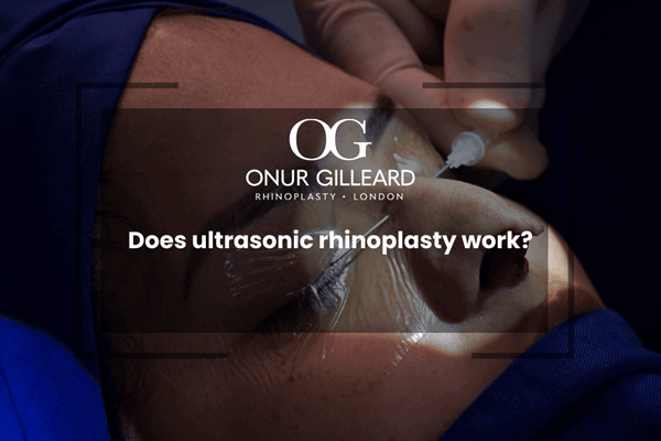 Does ultrasonic rhinoplasty work?