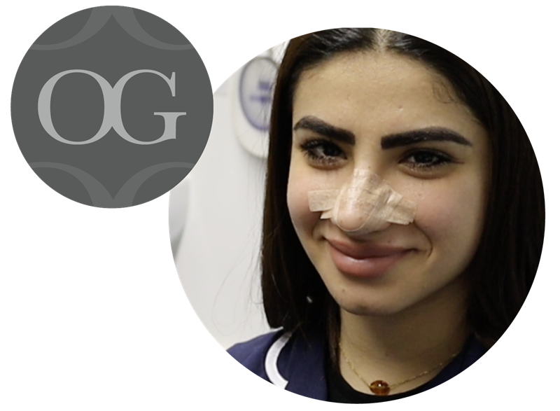 Rhinoplasty Journey